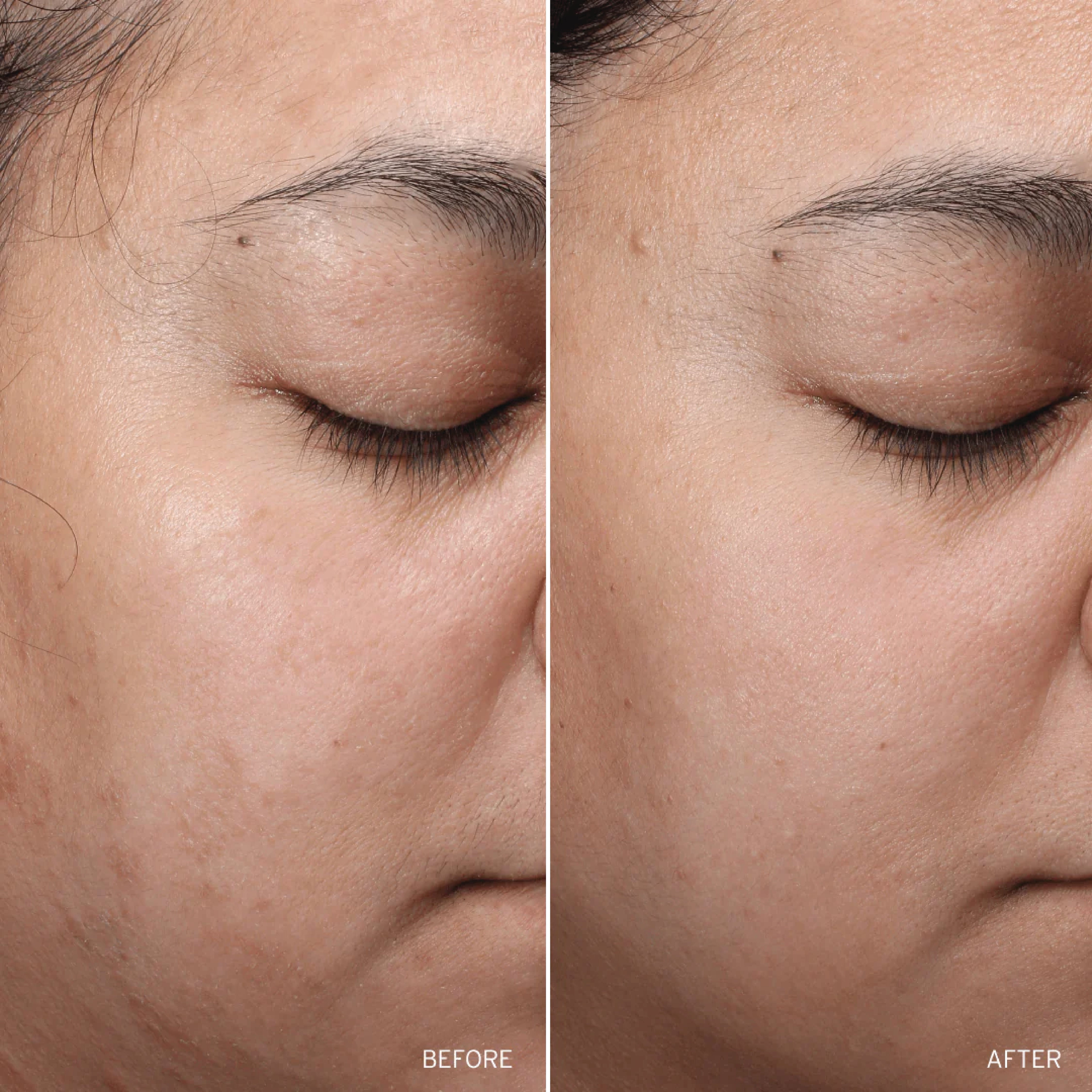 NAD+ Skin Transformation Set