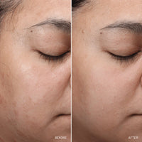 NAD+ Skin Transformation Set