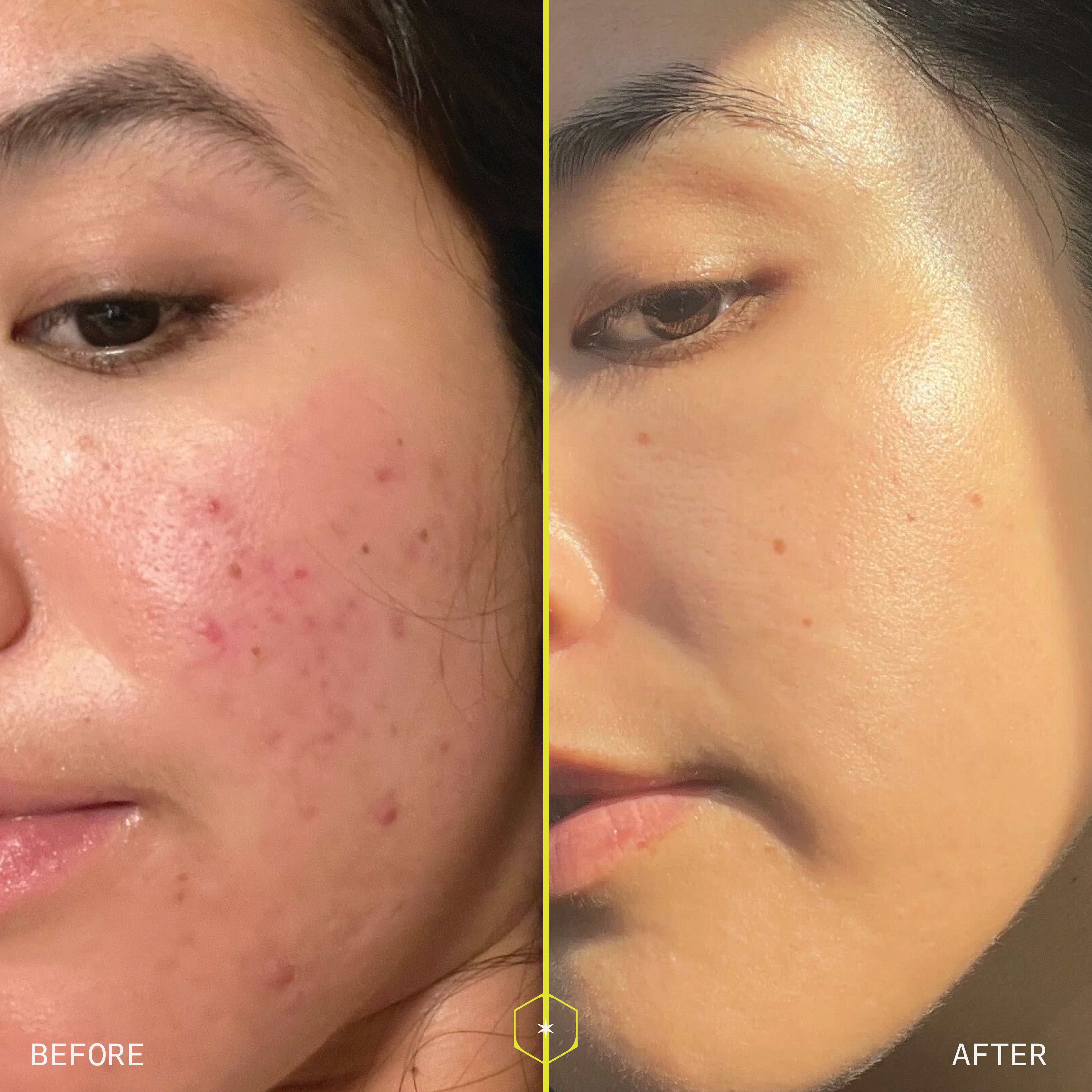 RETINOL PEPTIDE BOOSTING SERUM