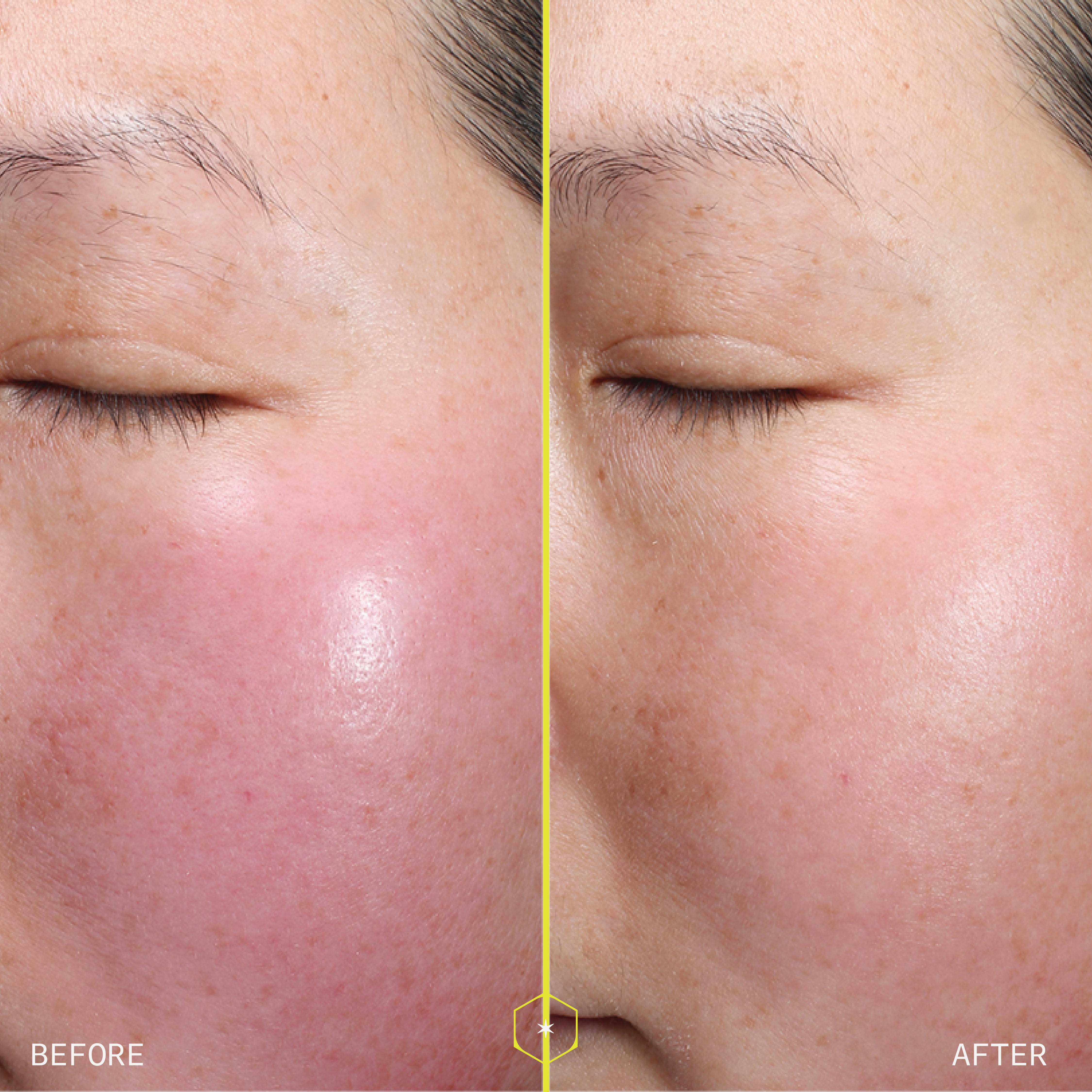 RETINOL PEPTIDE BOOSTING SERUM