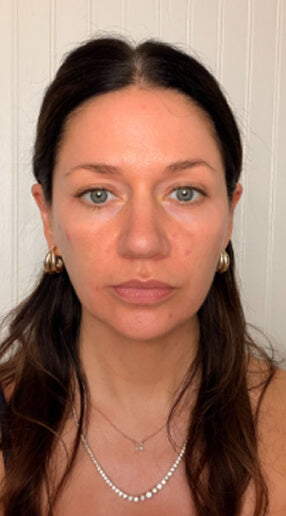 Jessica L before