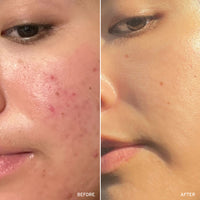 NAD+ Renew & Restore Bundle