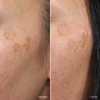 NAD+ Renew & Restore Bundle