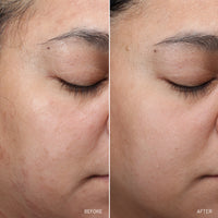 NAD+ Renew & Restore Bundle