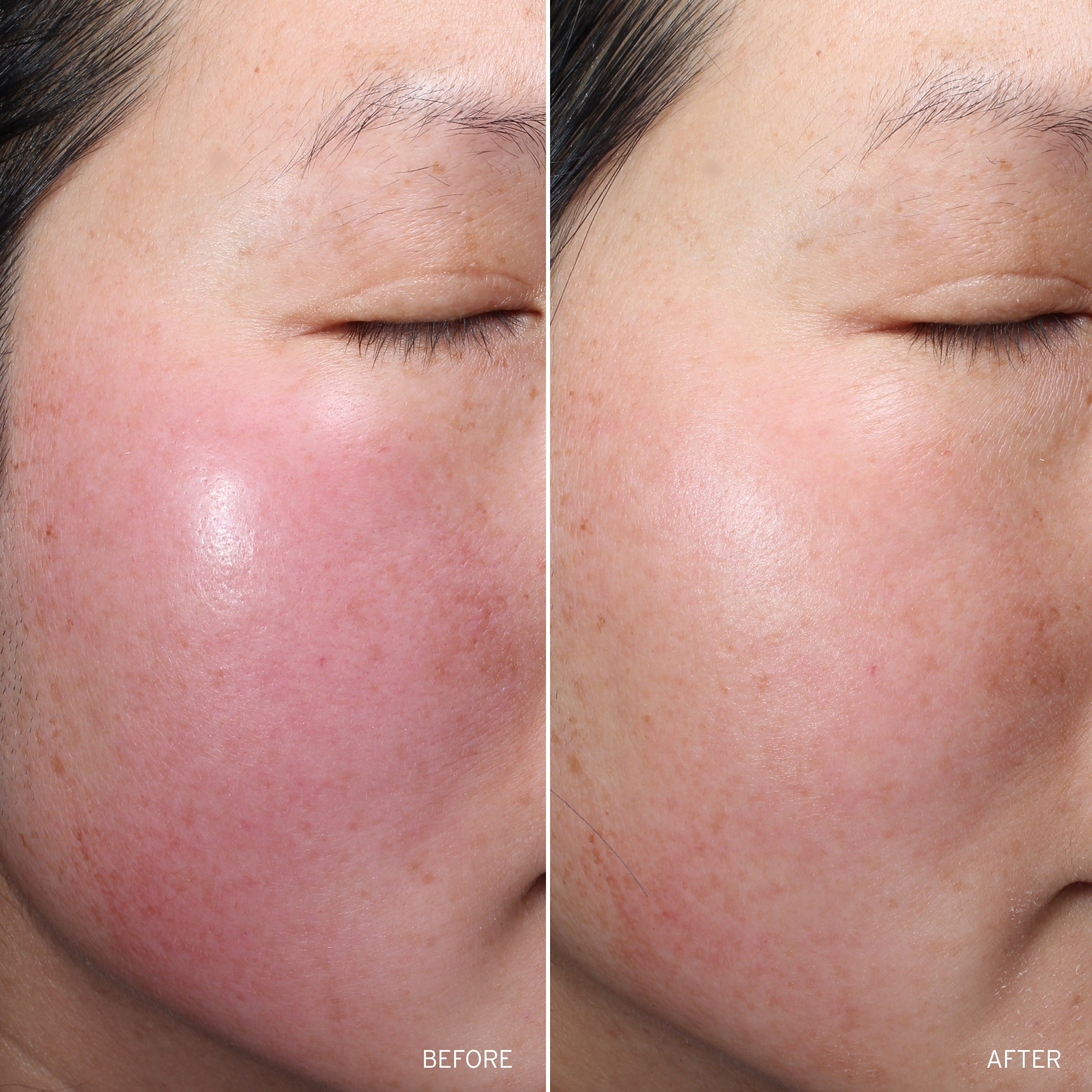 NAD+ Renew & Restore Bundle