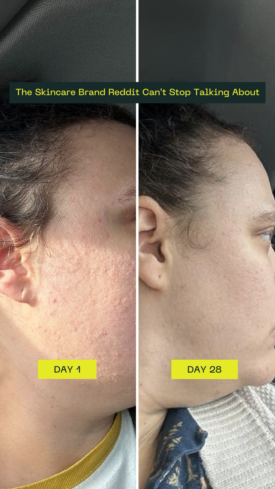 I tried the viral NAD+ treatment