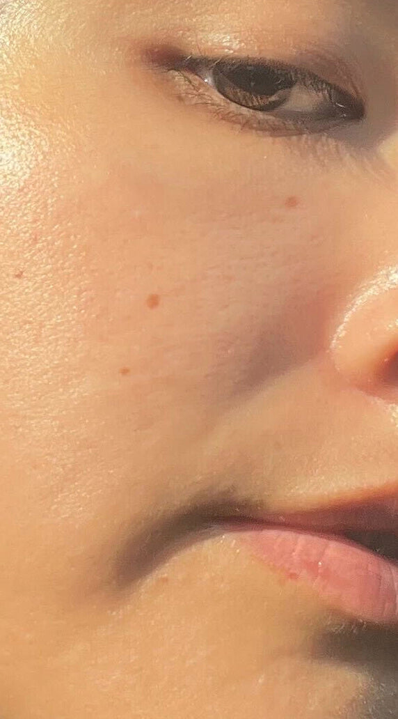 After treatment