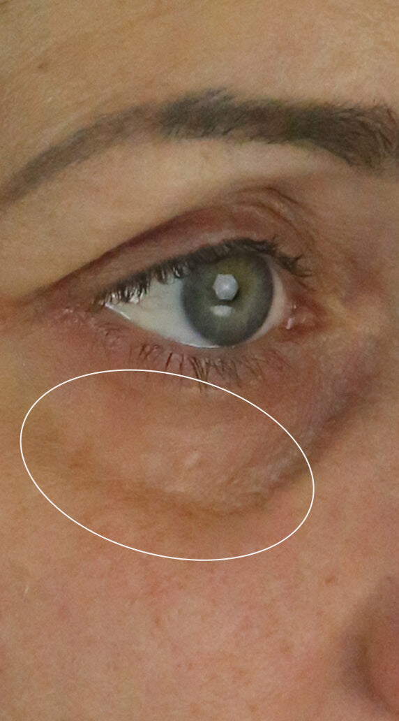 Before treatment