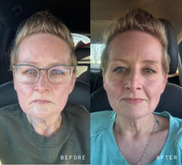 NAD+ Skin Transformation Set