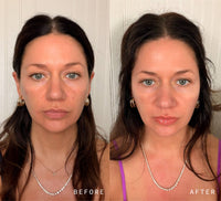 NAD+ Skin Transformation Set