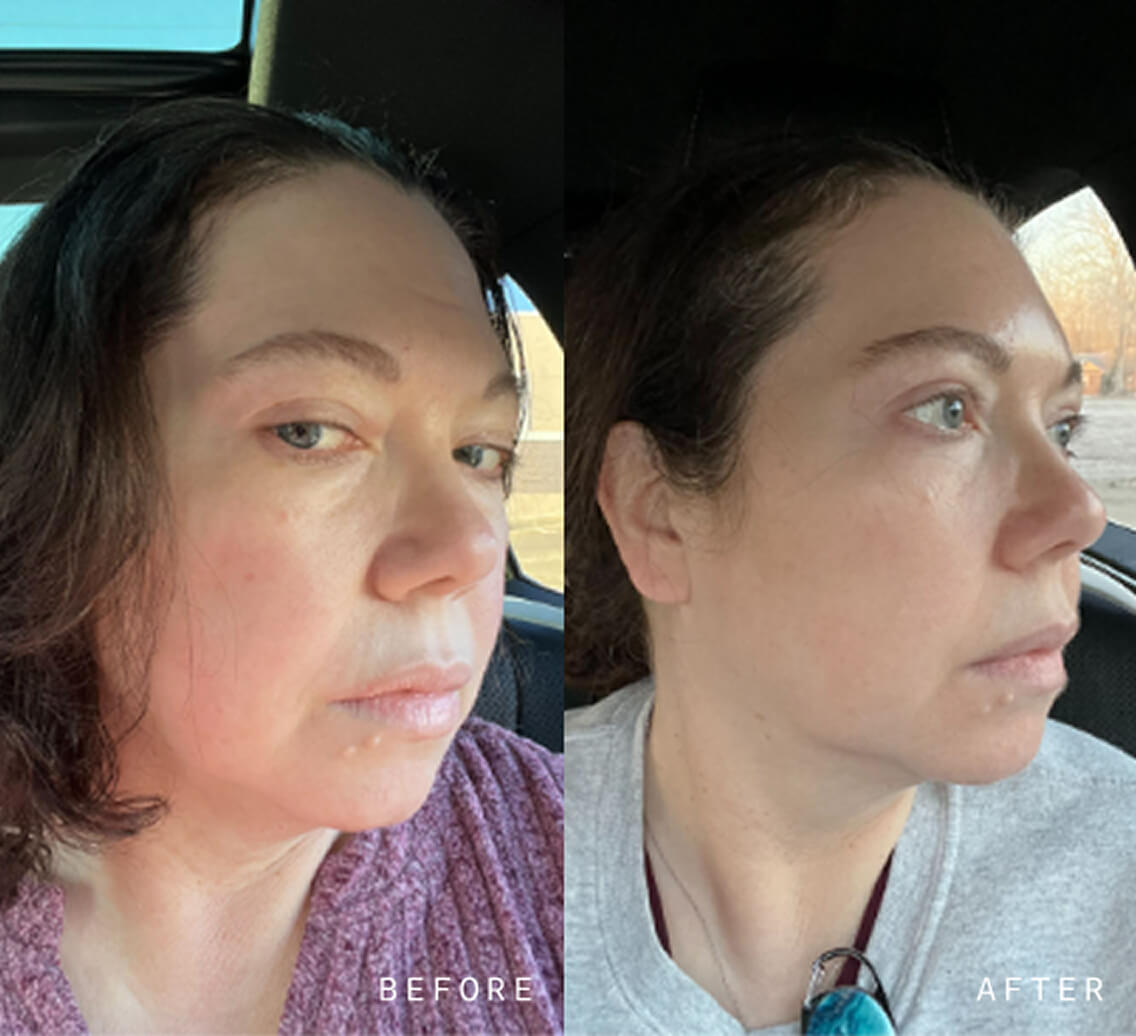 NAD+ Skin Transformation Set