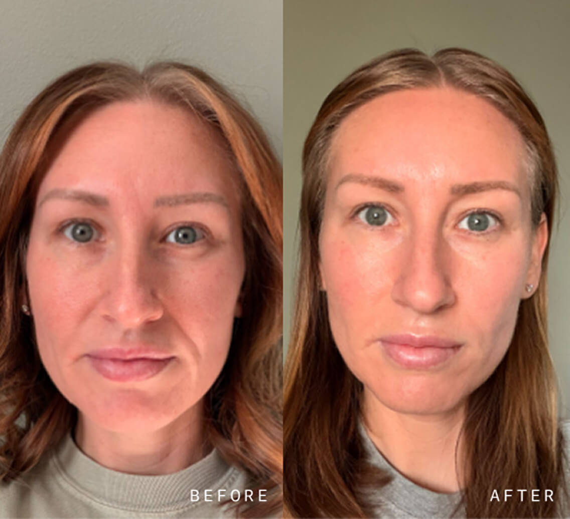 NAD+ Skin Transformation Set