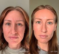 NAD+ Skin Transformation Set