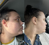 NAD+ Skin Transformation Set